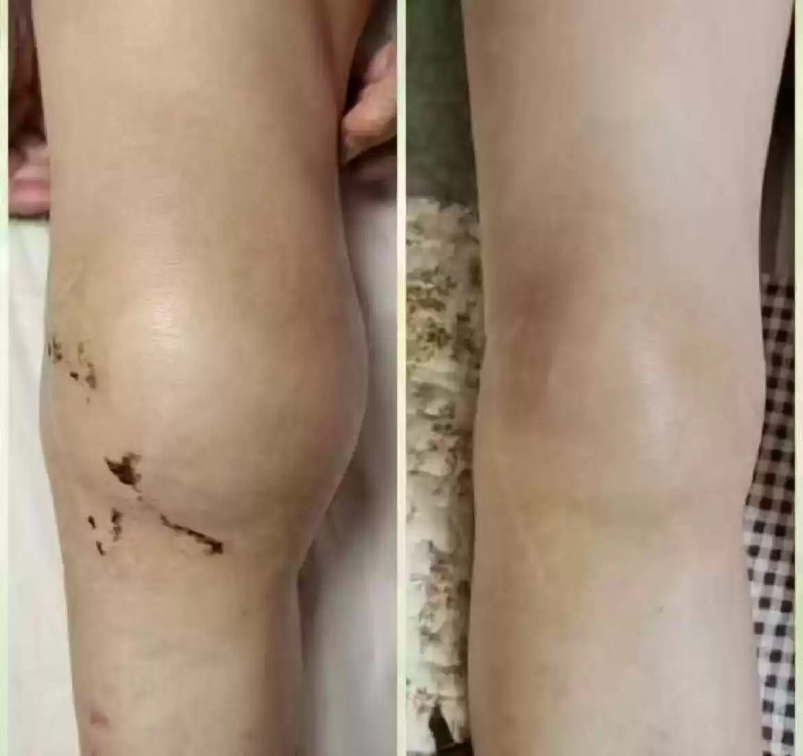 穿衣搭配女冬季 上了年纪的女人小心“老寒腿”,今年流行这么穿,个个保暖又时髦 穿衣搭配女冬季 上了年纪的女人小心“老寒腿”,今年流行这么穿,个个保暖又时髦