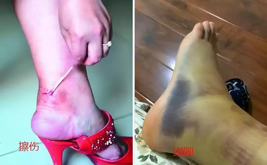 穿衣搭配女冬季 上了年纪的女人小心“老寒腿”,今年流行这么穿,个个保暖又时髦 穿衣搭配女冬季 上了年纪的女人小心“老寒腿”,今年流行这么穿,个个保暖又时髦